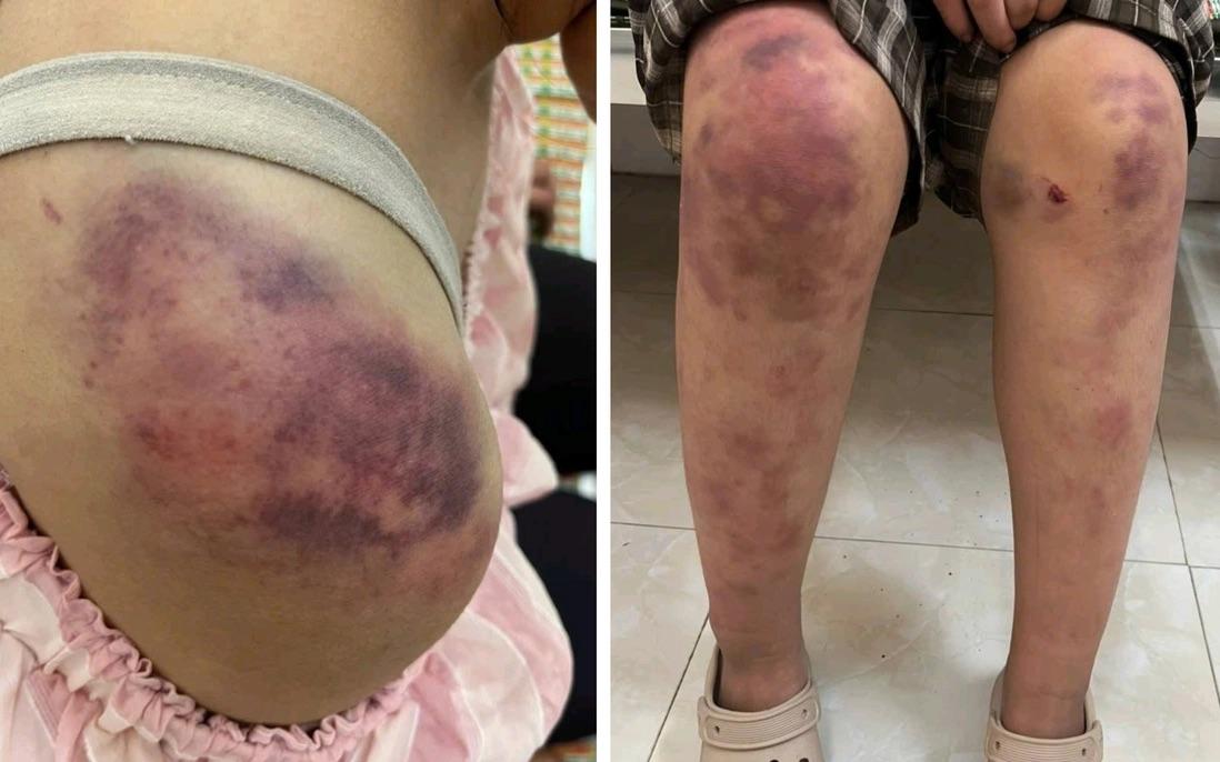 1000029741-17636236639321371553433-92-0-1342-2000-crop-1763792759648564057358