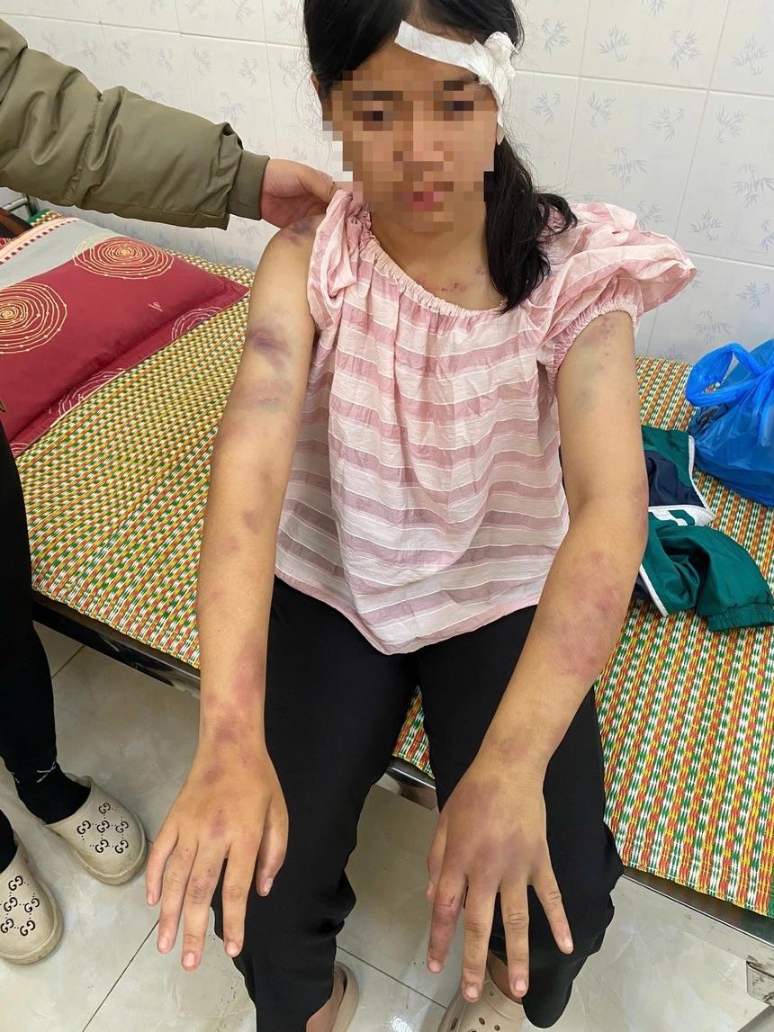 edit-58300276130552684613481242296247204919173557n-17636194082091398400077