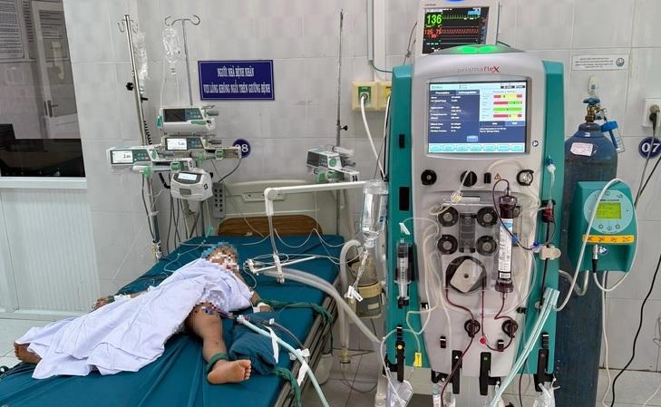 Bé 4 tuổi đang được lọc máu liên tục vì sốc phản vệ độ III sau khi bị ong vò vẽ đốt nhiều nhát. 4tuoi
