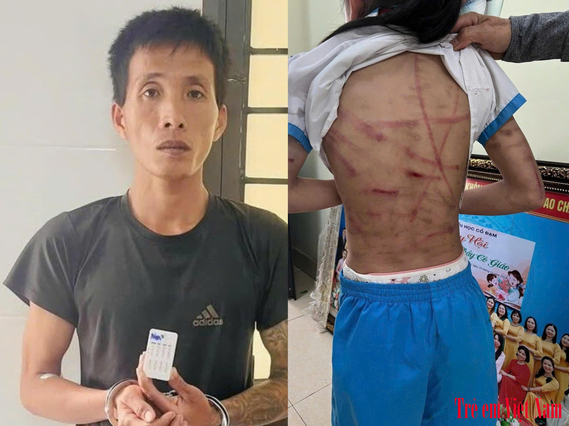 Cha dượng độc ác ra tay tàn độc với bé gái 10 tuổi, trên cơ thể và đầu cháu bé có rất nhiều vết thương cho thấy cháu đã bị đánh đập trong thời gian dài. cha dượng bạo hành bé gái hà tĩnh