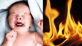 Hơ lửa quanh mặt 'đốt vía' cho trẻ sơ sinh: Vừa nguy hiểm vừa tiềm ẩn nhiều hệ lụy!