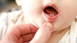 Cách chăm sóc nướu và răng mới mọc của trẻ