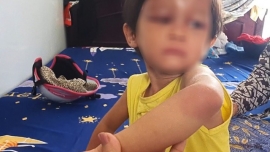 Cà Mau: Bắt tạm giam cha nuôi hành hạ con gái nuôi 4 tuổi