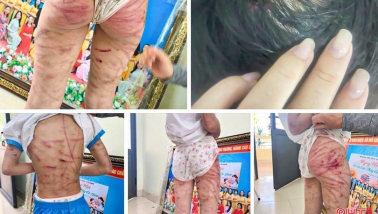 Xót xa hình ảnh bé gái ở Hà Tĩnh bị đánh đập tàn nhẫn