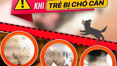 Bé gái 11 tuổi tử vong sau 2 tháng bị chó cắn