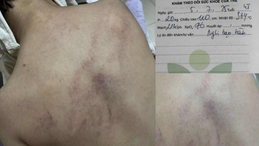 Hội BVQTE Việt Nam đề nghị khẩn trương làm rõ việc phụ huynh tố giáo viên bạo hành trẻ mầm non 4 tuổi