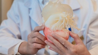 Ca thay van động mạch chủ qua da đầu tiên tại Việt Nam ứng dụng công nghệ in 3D cá thể hóa