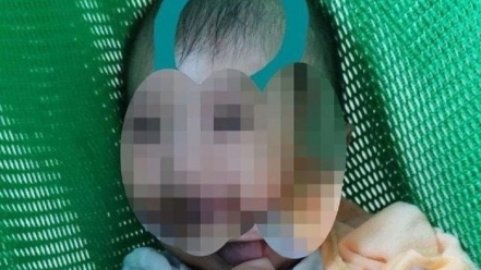 Bé trai 6 tháng tuổi bị bảo mẫu đánh dập não sau phẫu thuật giờ ra sao?