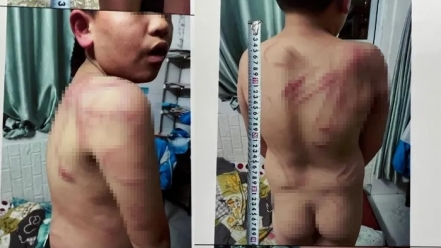 Lâm Đồng: Tạm giữ người cha bạo hành con trai ruột 10 tuổi