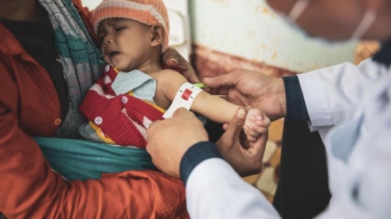 90% trẻ em bị suy dinh dưỡng cấp tính nặng ở Việt Nam không được điều trị