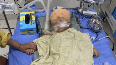 Sơn La: Xác minh vụ bé trai bị chấn thương não ở trường mầm non