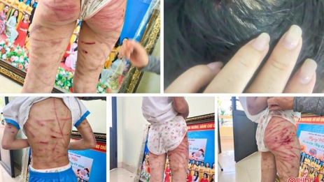 Xót xa hình ảnh bé gái ở Hà Tĩnh bị đánh đập tàn nhẫn