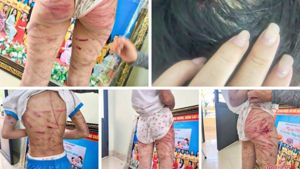 Xót xa hình ảnh bé gái ở Hà Tĩnh bị đánh đập tàn nhẫn