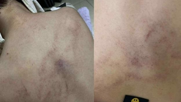 Hà Nội: Làm rõ vụ phụ huynh tố một giáo viên Trường Mầm non Gia Thụy bạo hành trẻ