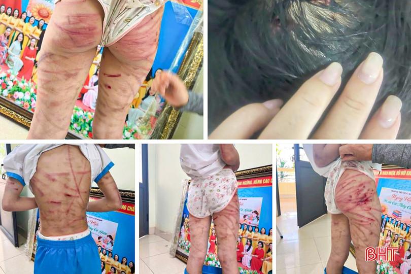 Xót xa hình ảnh bé gái ở Hà Tĩnh bị đánh đập tàn nhẫn