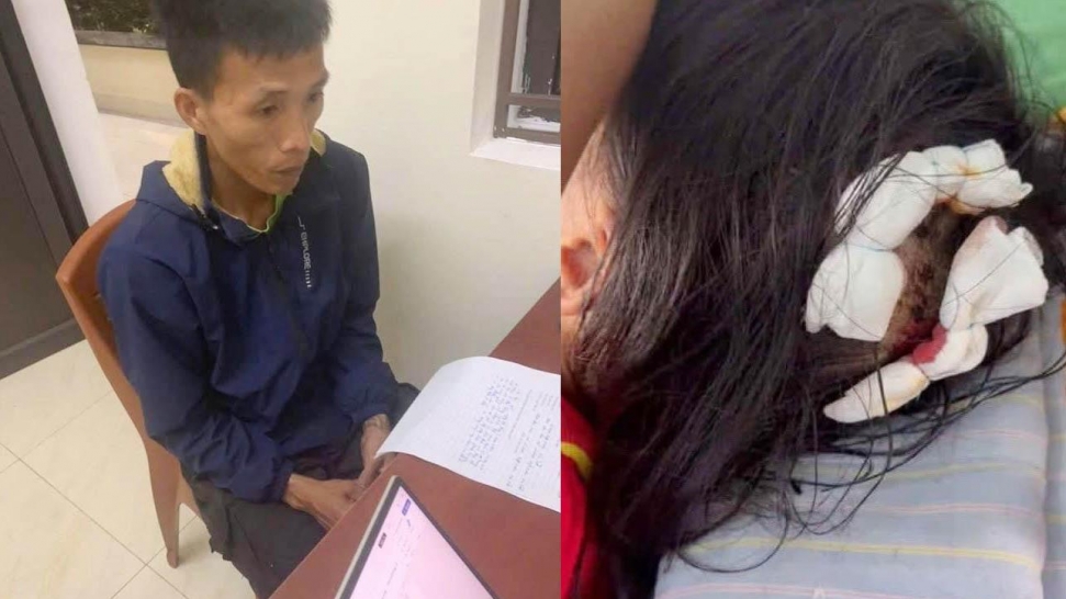 Bài học đắt giá nhìn từ vụ cha dượng bạo hành dã man bé gái ở Hà Tĩnh