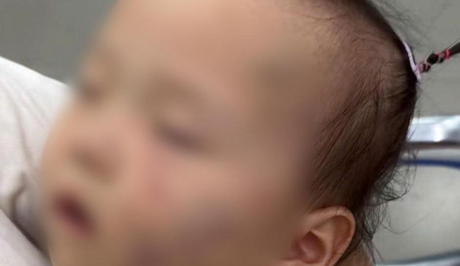 Tạm giữ giáo viên mầm non bị tố bạo hành bé gái hơn 1 tuổi ở Bắc Ninh