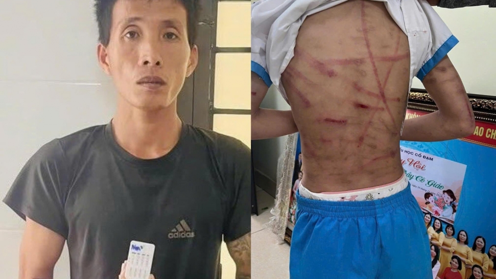Bài học đắt giá nhìn từ vụ cha dượng bạo hành dã man bé gái ở Hà Tĩnh